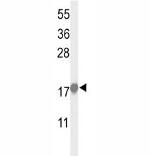 p21 Antibody