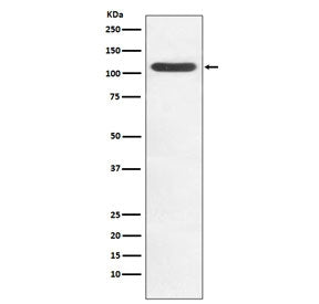 Western blot testing of human Jurkat cell lysate with HIP1 antibody. Predicted molecular weight ~116
