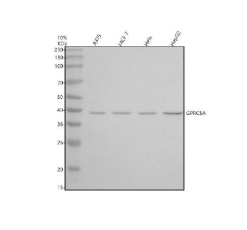 Western blot analysis of RAI3/GPRC5A using anti-GPRC5A antibody. Electrophoresis was performed on a 