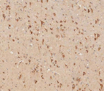 IHC testing of FFPE human brain tissue with Interferon alpha receptor 1 antibody. HIER: steam sectio