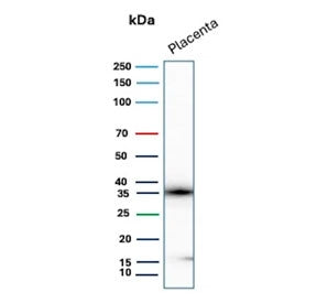 Western blot testing of human placental tissue lysate with Epstein-Barr virus induced 3 antibody (cl