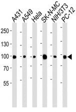 HSP90 Antibody