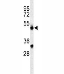 CFP Antibody