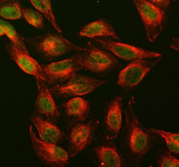 Immunofluorescent staining of FFPE human U-2 OS cells with Dnmt1 antibody (green) and Alpha Tubulin 