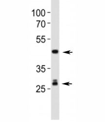 Shh Antibody / Sonic Hedgehog
