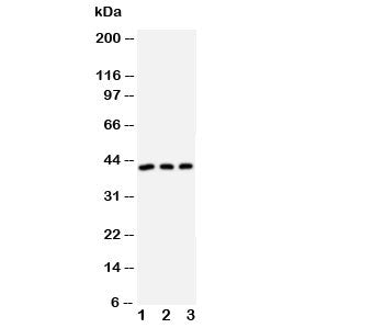 Western blot testing of DAPK2 antibody and Lane 1: U87; 2: MCF-7; 3: SMMC-7721 cell lysate
