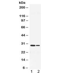 Neutrophil Elastase Antibody