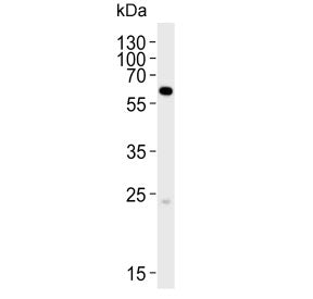 Western blot testing of human HepG2 cell lysate with SPAK antibody. Predicted molecular weight ~60 k