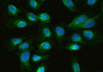 ARL13B Antibody / ADP-ribosylation factor-like protein 13B