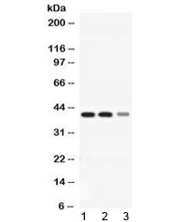Alcohol dehydrogenase 4 Antibody / ADH4
