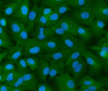 INF2 Antibody / Inverted formin-2