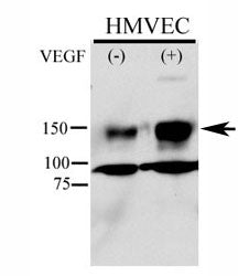 Phospho-KDR antibody used in western blot to detect phosphorylated KDR/FLK1 in HMVEC lysate. Endothe