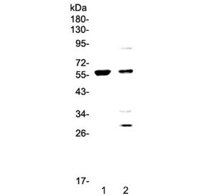Western blot testing of 1) human COLO-320 and 2) human PANC-1 cell lysate with PDK1 antibody at 0.5u