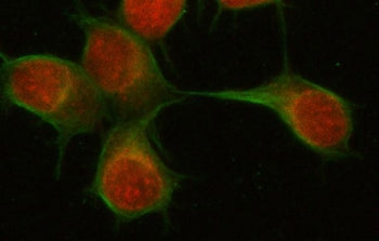 Immunofluorescent staining of FFPE human U-2 OS cells with PAPSS2 antibody (red) and Beta Tubulin mA
