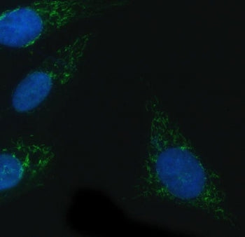 Immunofluorescent staining of FFPE human U-2 OS cells with NADPH oxidase 4 antibody (green) and DAPI