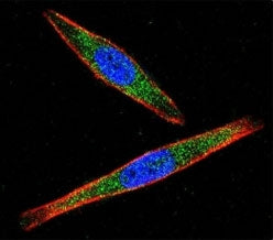 Confocal immunofluorescent analysis of LCK antibody with A2058 cells followed by Alexa Fluor 488-con