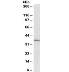Western blot testing of human spinal cord cancer lysate with CD38 antibody at 2ug/ml. Expected molec