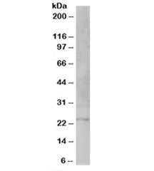 Western blot testing of human testis lysate with VSP28 antibody at 1ug/ml. Predicted molecular weigh