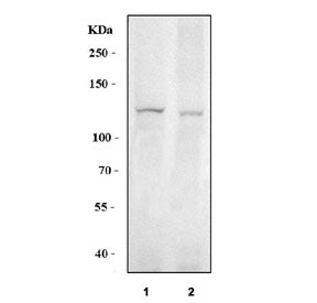 BK channel Antibody (KCNMA1)