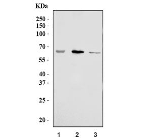 Western blot testing of human 1) A375, 2) A431 and 3) HaCaT cell lysate with TYR antibody. Predicted
