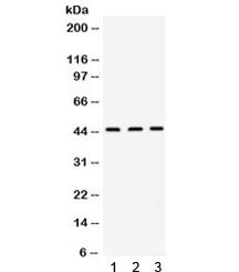 Orosomucoid 1 Antibody / ORM1