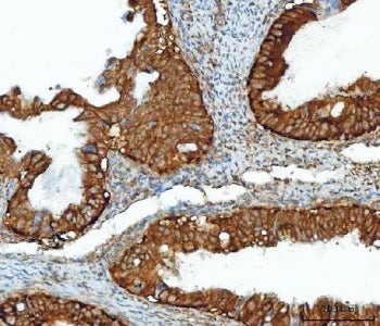 Inosine-5'-monophosphate dehydrogenase 2 Antibody / IMPDH2