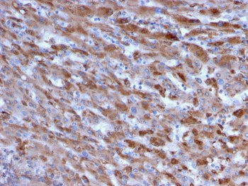 IHC staining of FFPE human liver with C1QA antibody. HIER: boil tissue sections in pH 9 10mM Tris wi