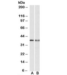 Western blot testing of U937 [A] and human spleen [B] lysates with CAPG antibody at 0.3ug/ml. Predic