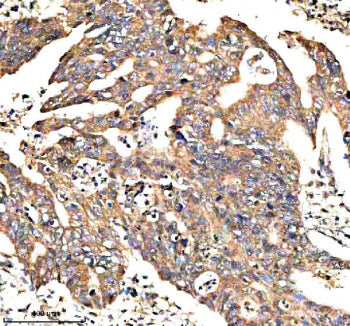 IHC analysis of NEK9 using anti-NEK9 antibody. NEK9 was detected in a paraffin-embedded section of h