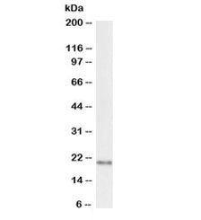 Western blot testing of rat brain lysate with biotinylated FTL antibody at 1ug/ml. Predicted molecul