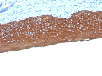 Pan Cytokeratin Antibody Cocktail (Acidic + Basic)