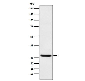 Western blot testing of human HEK293 cell lysate with EIF4E antibody. Predicted molecular weight ~27