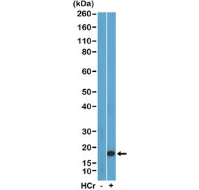 Western blot testing of acid extracts of HeLa cells with or without sodium crotonate treatment using