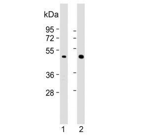 Western blot testing of human 1) A431 and 2) NCI-H460 cell lysate with Brachyury antibody. Predicted molecular weight ~47 kDa.