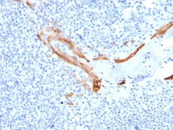 KRT16 Antibody / Cytokeratin 16
