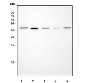 Western blot testing of 1) rat spleen, 2) rat PC-12, 3) mouse spleen, 4) mouse kidney and 5) mouse R