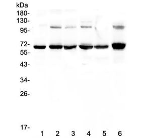 Western blot testing of human 1) COLO-320, 2) A549, 3) HepG2, 4) MDA-MB-231, 5) PANC-1 and 6) A375 l