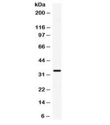 IP10 Antibody / CXCL10