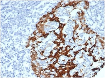 Keratin 6A Antibody / Cytokeratin 6A
