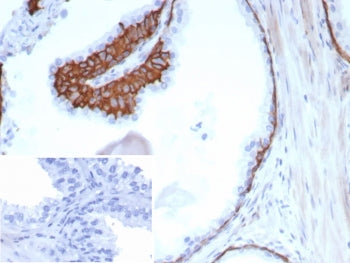 IHC staining of FFPE human prostate tissue with CK13 antibody (clone KRT13/8577R). Inset: PBS used i