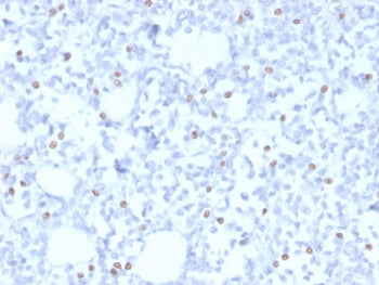 Estrogen Receptor beta 5 Antibody