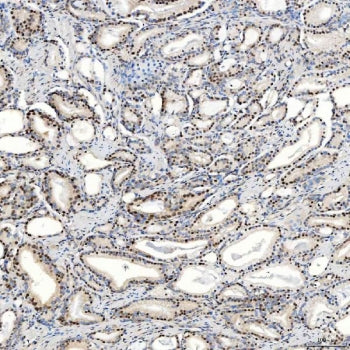 U1 snRNP C Antibody / SNRPC