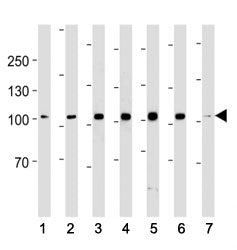 Angiotensin-Converting Enzyme 2 Antibody (ACE2)