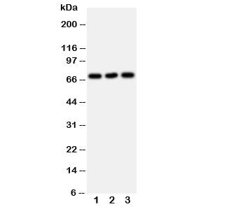 Western blot testing of SERT antibody and Lane 1: U87; 2: HeLa; 3: Jurkat cell lysate. Expected mole