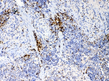 IL-17A Antibody