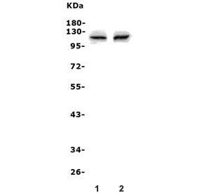 Western blot testing of 1) rat kidney and 2) mouse kidney lysate with Pms2 antibody. Expected molecu