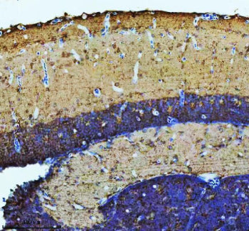 IHC staining of FFPE zebrafish brain tissue with Zebrafish Atp6v1b2 antibody, HRP secondary and DAB 