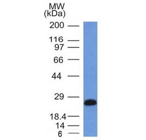 CD79a Antibody