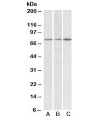 Western blot testing of human cerebral cortex [A], human frontal cortex [B] and mouse brain [C] lysa