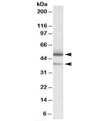 TXNDC5 Antibody